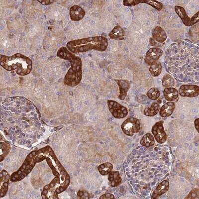 Immunohistochemistry-Paraffin: ZMYM5 Antibody [NBP2-13551]