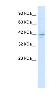 Western Blot: ZMYM5 Antibody [NBP1-80041]