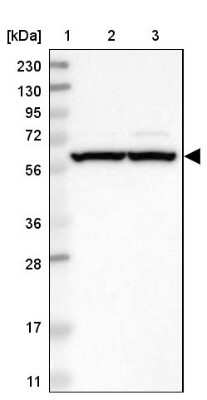 Western Blot: ZMYM5 Antibody [NBP2-13551]