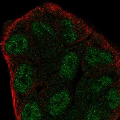 Immunocytochemistry/ Immunofluorescence: ZMYM6 Antibody [NBP2-57924]