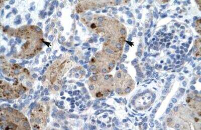 Immunohistochemistry-Paraffin: ZMYM6 Antibody [NBP1-80053]