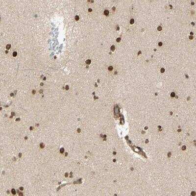 Immunohistochemistry-Paraffin: ZMYM6 Antibody [NBP1-88520]