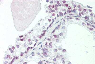 Immunohistochemistry-Paraffin: ZMYM6 Antibody [NBP2-88640]
