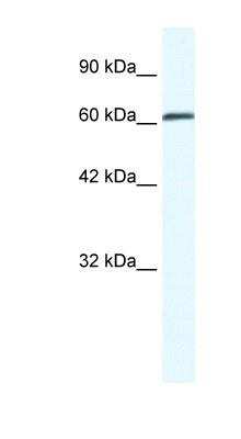 Western Blot: ZMYM6 Antibody [NBP1-80053]