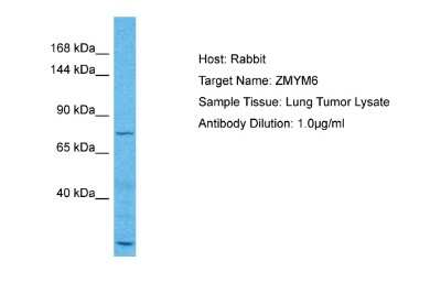 Western Blot: ZMYM6 Antibody [NBP2-88640]