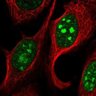 Immunocytochemistry/ Immunofluorescence: ZMYM6NB Antibody [NBP2-14717]