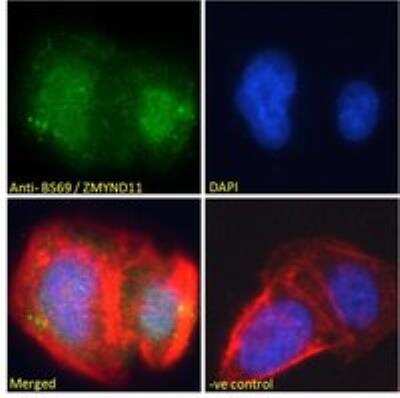 Immunocytochemistry/ Immunofluorescence: ZMYND11 Antibody [NB100-1157]