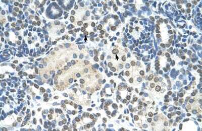 Immunohistochemistry: ZMYND11 Antibody [NBP2-86909]