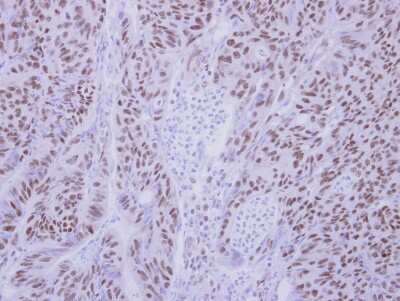 Immunohistochemistry-Paraffin: ZMYND11 Antibody [NBP2-20960]