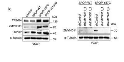 Knockdown Validated: ZMYND11 Antibody [NBP2-20960]