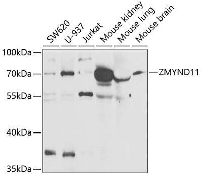 Western Blot: ZMYND11 AntibodyBSA Free [NBP2-94400]