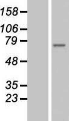 Western Blot: ZMYND11 Overexpression Lysate [NBL1-18049]