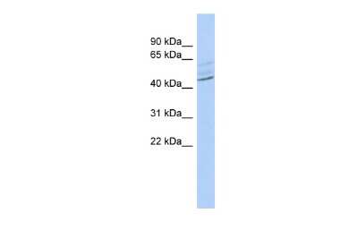 Western Blot: ZMYND12 Antibody [NBP2-84348]