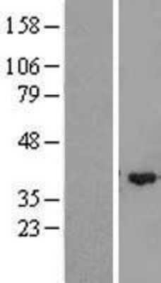 Western Blot: ZMYND12 Overexpression Lysate [NBL1-18050]