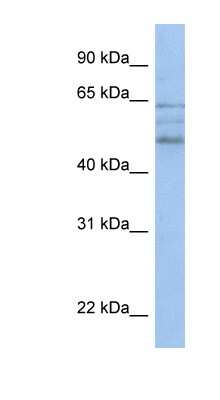 Western Blot: ZMYND17 Antibody [NBP1-79364]