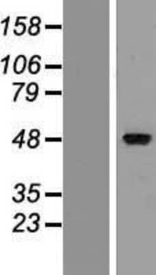 Western Blot: ZMYND17 Overexpression Lysate [NBL1-18051]