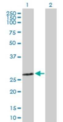 Western Blot: ZMYND19 Antibody [H00116225-B01P]