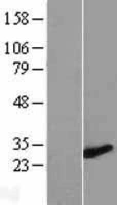 Western Blot: ZMYND19 Overexpression Lysate [NBL1-18052]