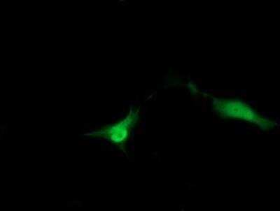 Immunocytochemistry/ Immunofluorescence: ZNDR1 Antibody (OTI1G2) [NBP2-45441]