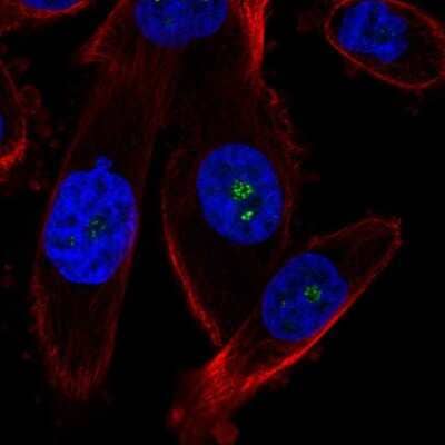 Immunocytochemistry/ Immunofluorescence: ZNDR1 Antibody [NBP2-55396]