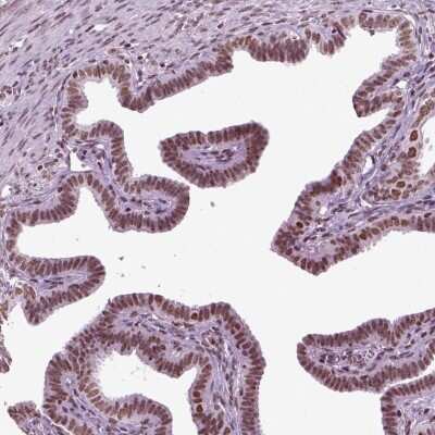 Immunohistochemistry: ZNDR1 Antibody [NBP2-69057]