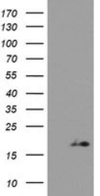 Western Blot: ZNDR1 Antibody (OTI1G2)Azide and BSA Free [NBP2-74930]