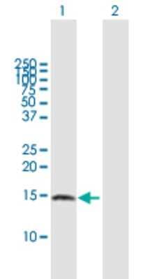 Western Blot: ZNDR1 Antibody [H00030834-B01P]