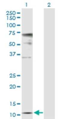 Western Blot: ZNDR1 Antibody [H00030834-D01P]