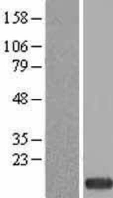 Western Blot: ZNDR1 Overexpression Lysate [NBL1-18262]