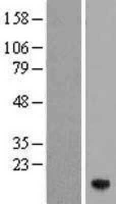 Western Blot: ZNDR1 Overexpression Lysate [NBP2-10313]