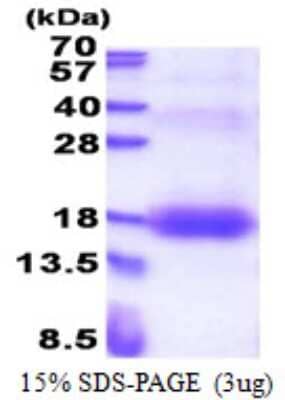 SDS-PAGE: Recombinant Human ZNDR1 His Protein [NBP2-22963]