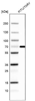 Western Blot: ZNF10 Antibody (CL9744) [NBP2-88939]