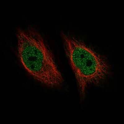 Immunocytochemistry/ Immunofluorescence: ZNF10 Antibody (CL9747) [NBP2-88940]