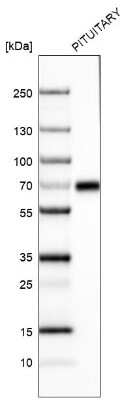 Western Blot: ZNF10 Antibody (CL9747) [NBP2-88940]