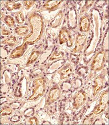 Immunohistochemistry-Paraffin: ZNF10 Antibody - BSA Free [NBP2-59679]