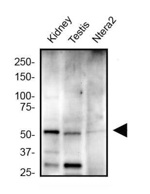 Western Blot: ZNF10 AntibodyBSA Free [NBP2-59679]