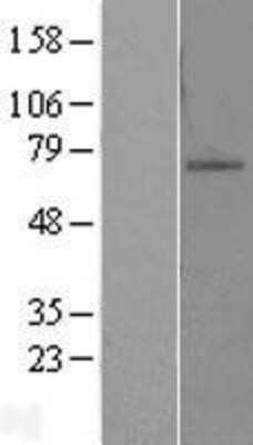 Western Blot: ZNF10 Overexpression Lysate [NBL1-18053]