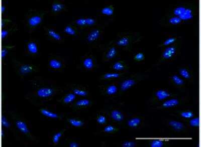 Immunocytochemistry/ Immunofluorescence: ZNF100 Antibody (3C3) [H00163227-M01-100ug]