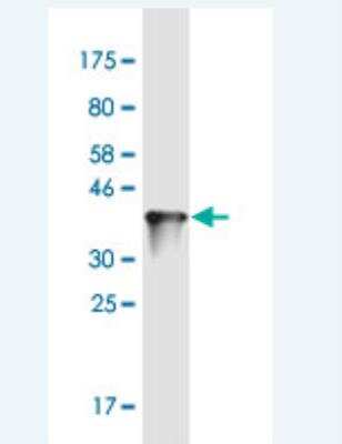 Western Blot: ZNF100 Antibody (3C3) [H00163227-M01-100ug]