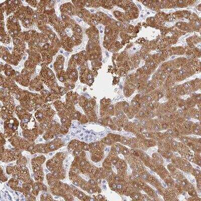 Immunohistochemistry-Paraffin: ZNF100 Antibody [NBP2-32429]