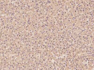 Immunohistochemistry-Paraffin: ZNF100 Antibody [NBP2-97820]