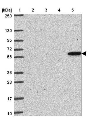 Western Blot: ZNF100 Antibody [NBP2-32429]