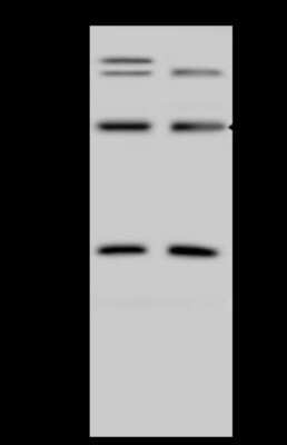 Western Blot: ZNF100 Antibody [NBP2-97820]