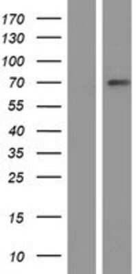 Western Blot: ZNF100 Overexpression Lysate [NBP2-05109]