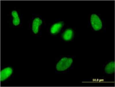 Immunocytochemistry/ Immunofluorescence: ZNF101 Antibody (2D5) [H00094039-M01]