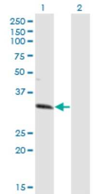 Western Blot: ZNF101 Antibody (2D5) [H00094039-M01]