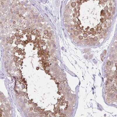 Immunohistochemistry-Paraffin: ZNF101 Antibody [NBP2-33755]