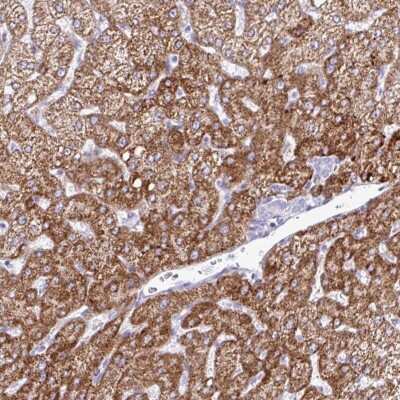 Immunohistochemistry-Paraffin: ZNF101 Antibody [NBP2-34197]