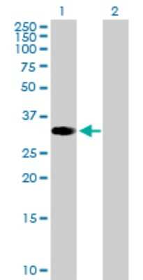 Western Blot: ZNF101 Antibody [H00094039-B01P]