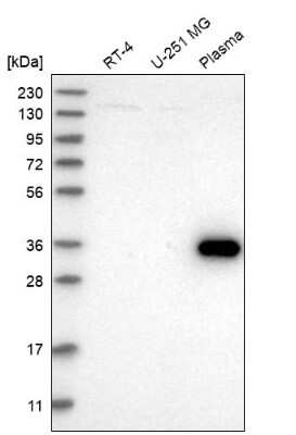 Western Blot: ZNF101 Antibody [NBP2-34197]